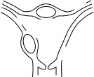 patología ginecológica